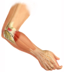 King Brand Coldcure Cold Therapy Provides Relief of Pain and Swelling on Elbow Injuries King Brand Coldcure Cold Therapy Provides Relief of Pain and Swelling on Elbow Injuries
